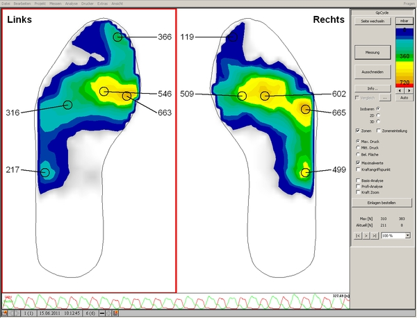 GebioMized Zusatz Fussanalyse